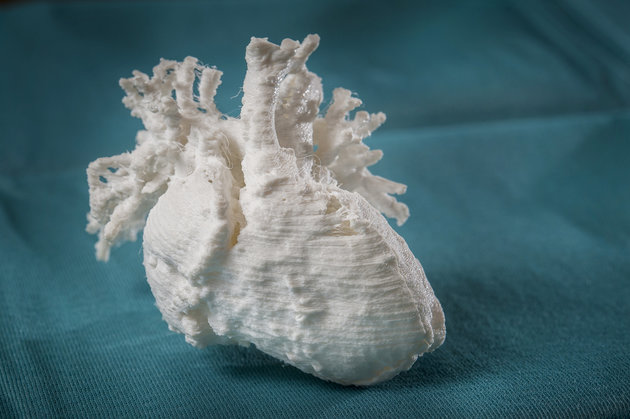 3D printed model of a childs heart. Photo Credit: Getty Images