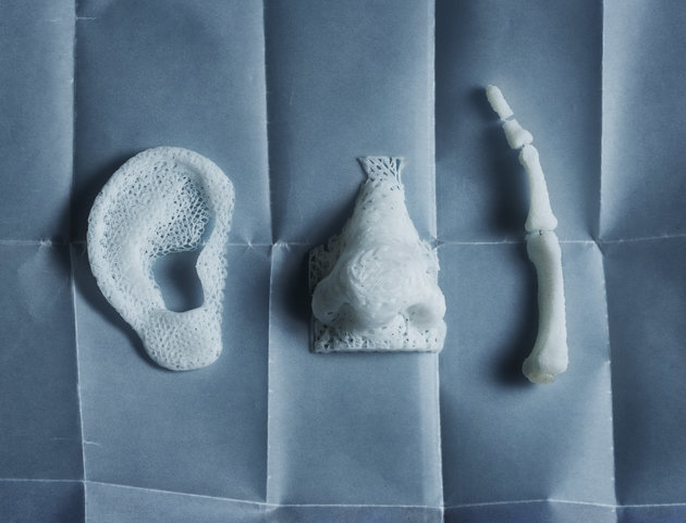 3D printed models of a human ear, nose and bones of a finger. Photo Credit: Getty Images