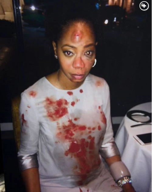 Spider Man Actress La Rivers Is Brutally Attacked By Nigntclub Owner Over A Taxi Cab