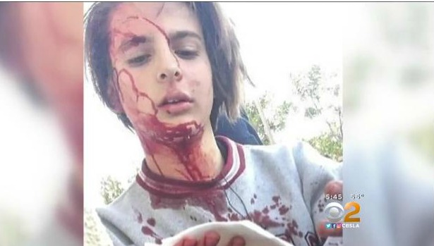 Hundreds Rally Against Bullying When Video Snapchat Was Posted Of Teen Being Brutally Beaten