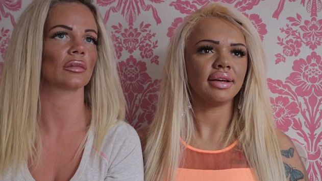 Mother & Daughter Spends $80K On Plastic Surgery To Look Like This!
