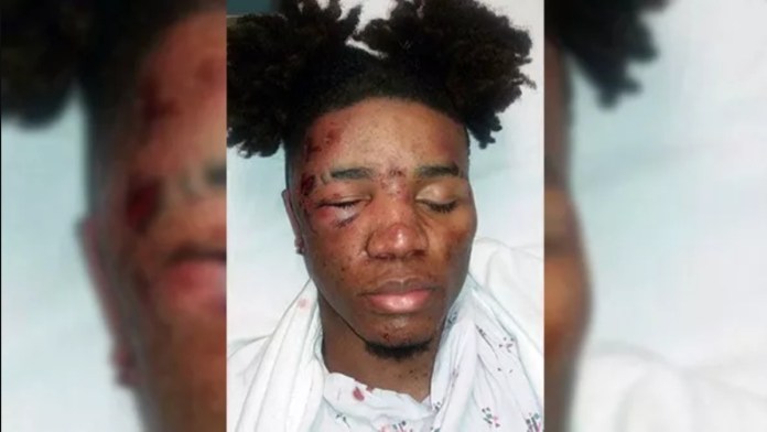 Black Teens Beaten For Talking To White Girl At Christmas Party