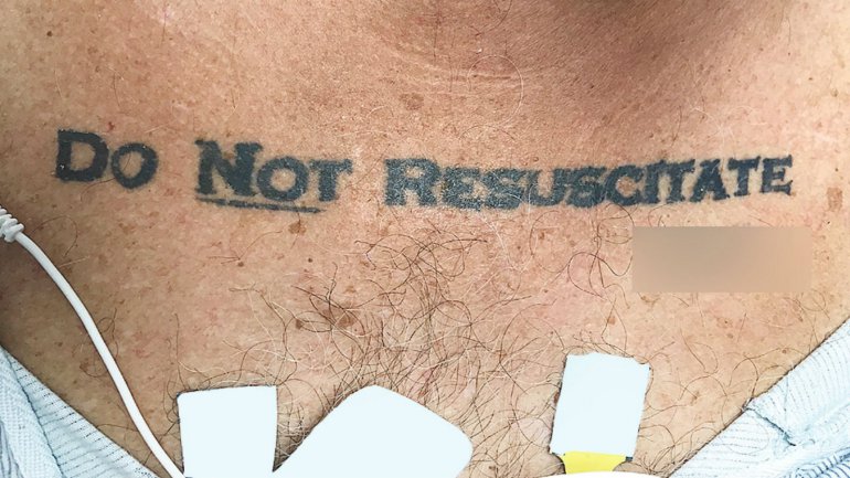 Ultimately, a do not resuscitate order was issued, and the man died. The authors of the study said they were “relieved to find his written DNR request,” but the initial confusion over the tattoo brought up a curious issue that has been debated in the medical community on several occasions.