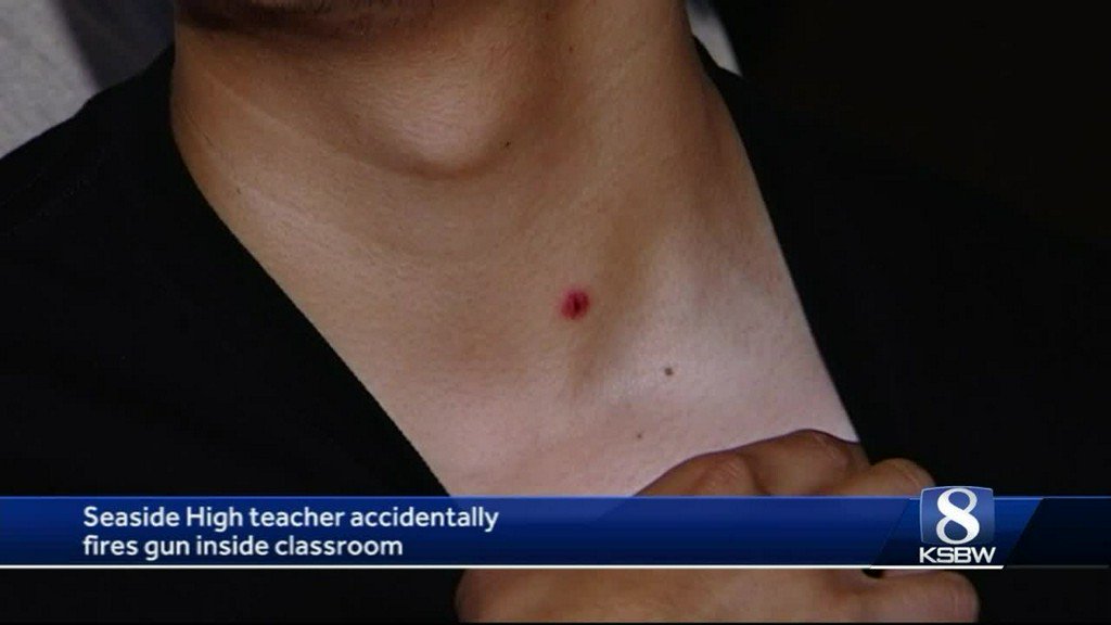 Teacher Fires Gun & Accidentally Injures Student During Safety Lesson When Fragments Hit Student In Neck