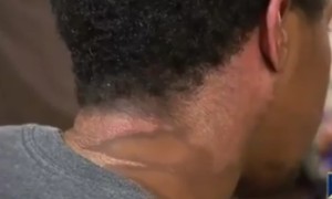 Father Pours Boiling Water On Gay Son After Catching Him In His Home With A Man