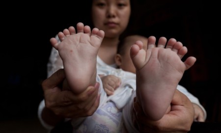 Chinese Baby Born With 31Fingers & Toes; Parents Are Praying For Surgery