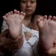 Chinese Baby Born With 31Fingers & Toes; Parents Are Praying For Surgery