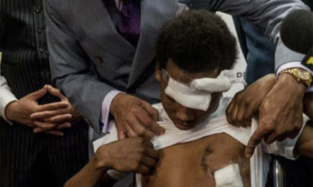 Did You Know: NYPD Who Smashed 14 Year Old boys Head & Chest Through Plate-Glass Window Nearly Killing Him Was Never Charged