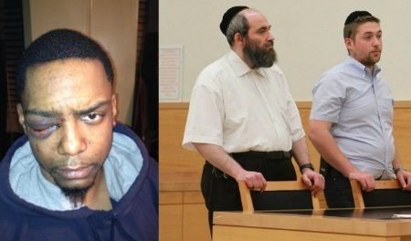 Hasidic Jewish Men Beat & Blinded Gay Black Man In One Eye & Only gets 150 Hours Of Community Service