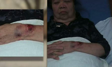 Police Sick K-9 Unit On 81-Year Old Woman Accusing Her Of Breaking Into Her Own House, She Was Bitten By Dog