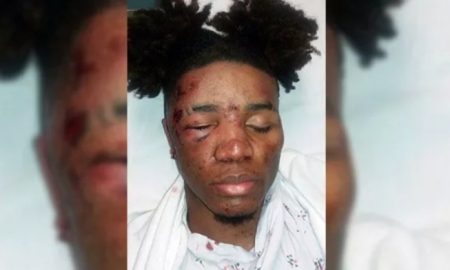 Black Teens Beaten For Talking To White Girl At Christmas Party