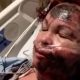 White Woman Pours Acid On Her Own Face, Destroying Her Skin & Blames A Black Woman Who Does Not Exist