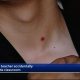 Teacher Fires Gun & Accidentally Injures Student During Safety Lesson When Fragments Hit Student In Neck