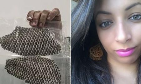 Talapia Fish Skin Is Used To Make A Vagina For Woman Born Without One