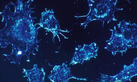 HEALTH NEWS: Cancer Cure Me Be One Year Away According To Israeli Scientists